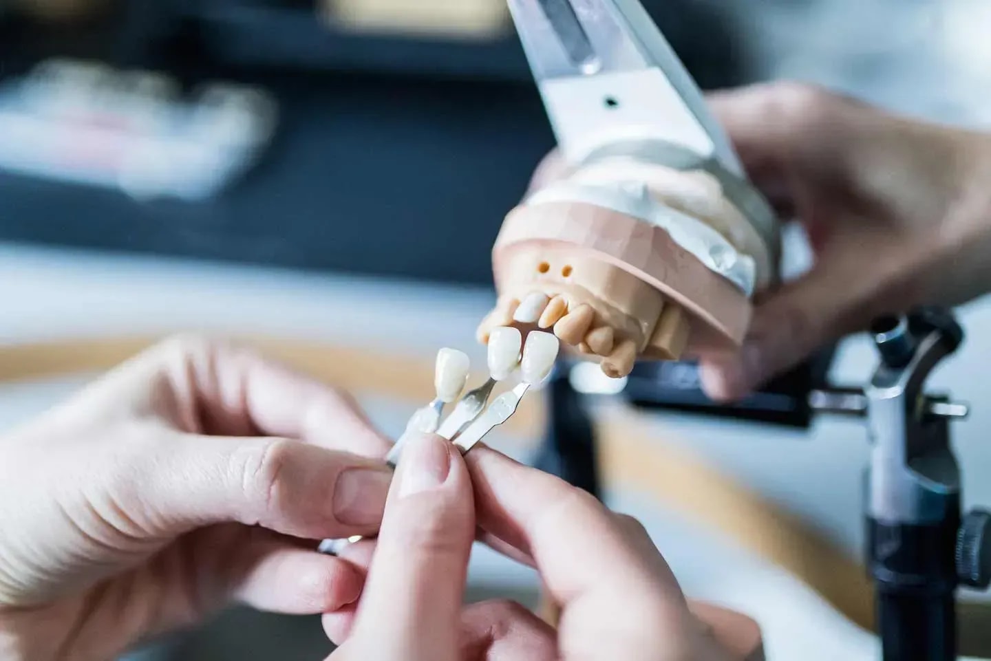 Welche Zahnersatz-Optionen gibt es bei vollständigem Zahnverlust?